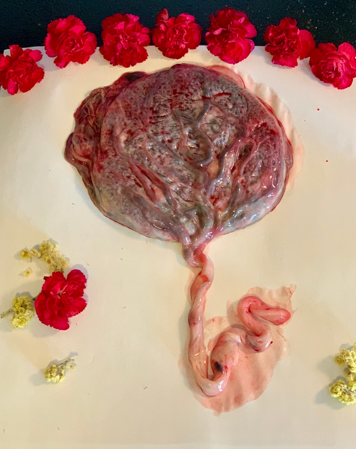 Postpartum Healing Placenta Magic